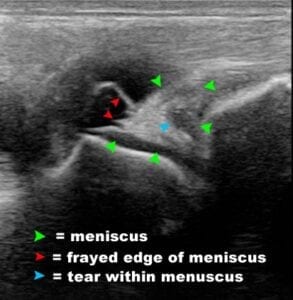 equine ultrasound meniscus tear