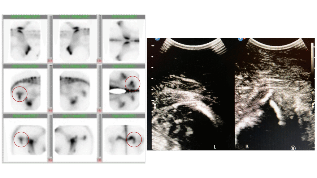 Bone Scan in Barrel Horse